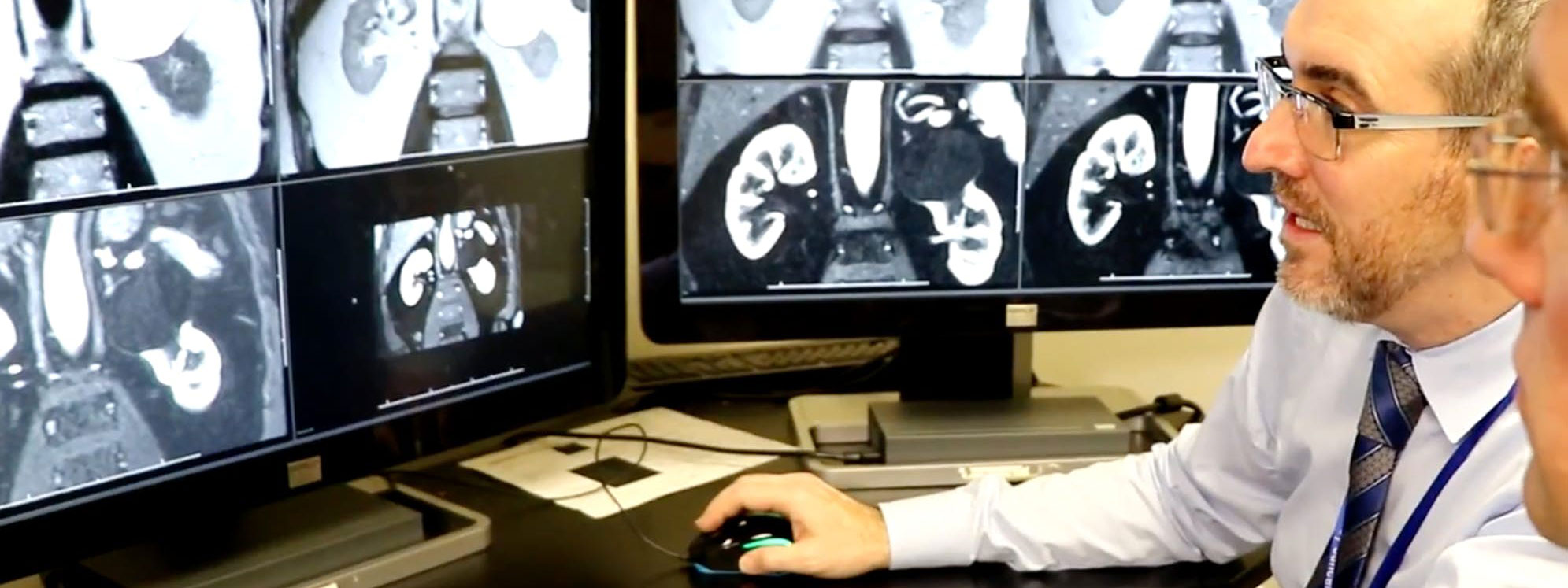 Kỹ thuật MRI tiên tiến sẽ giúp xác định khối u ung thư mà không cần sinh thiết