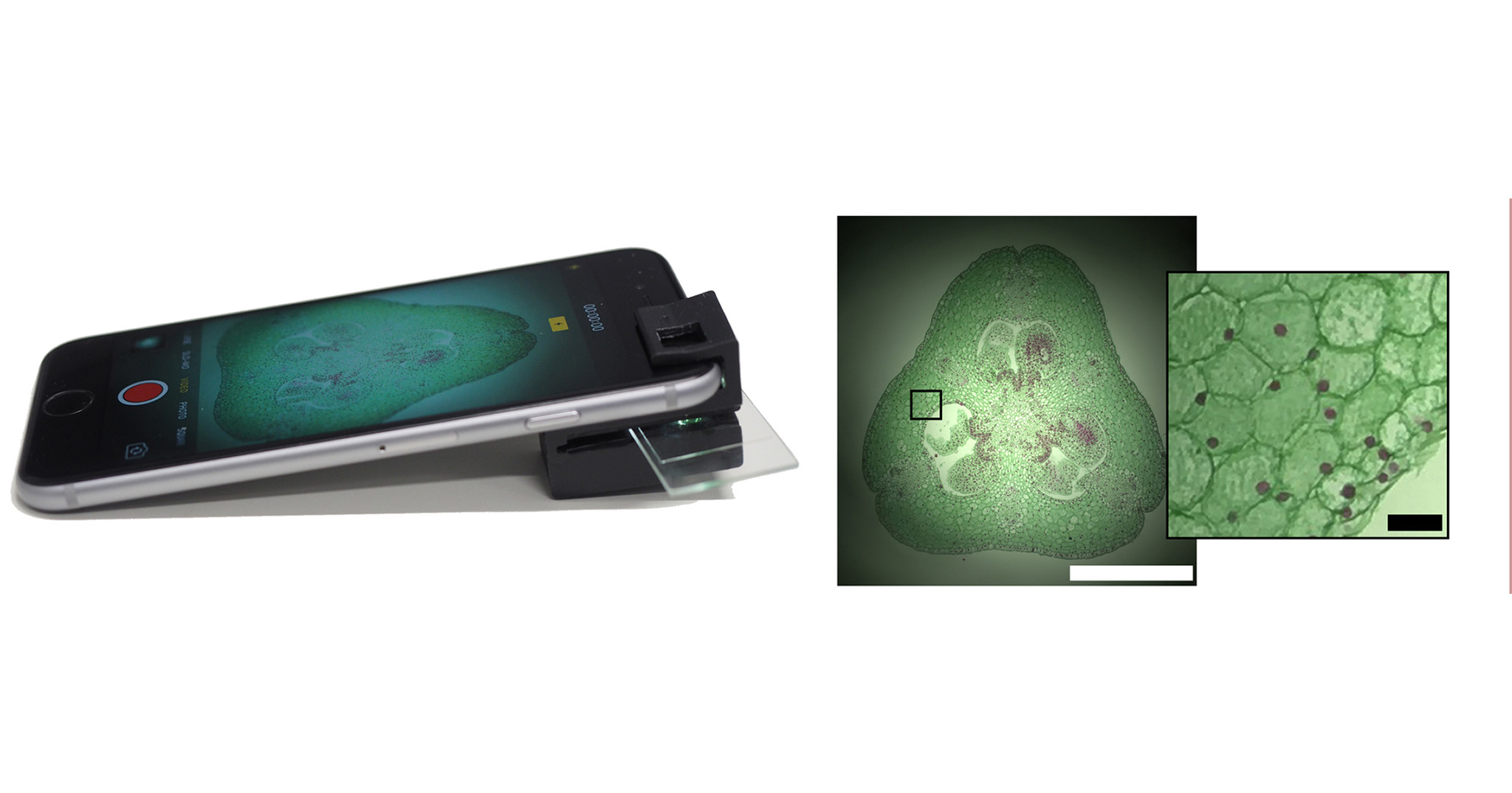Kính hiển vi kẹp vào điện thoại được in 3D, có thể soi đến cấp độ tế bào, không cần pin để hoạt động