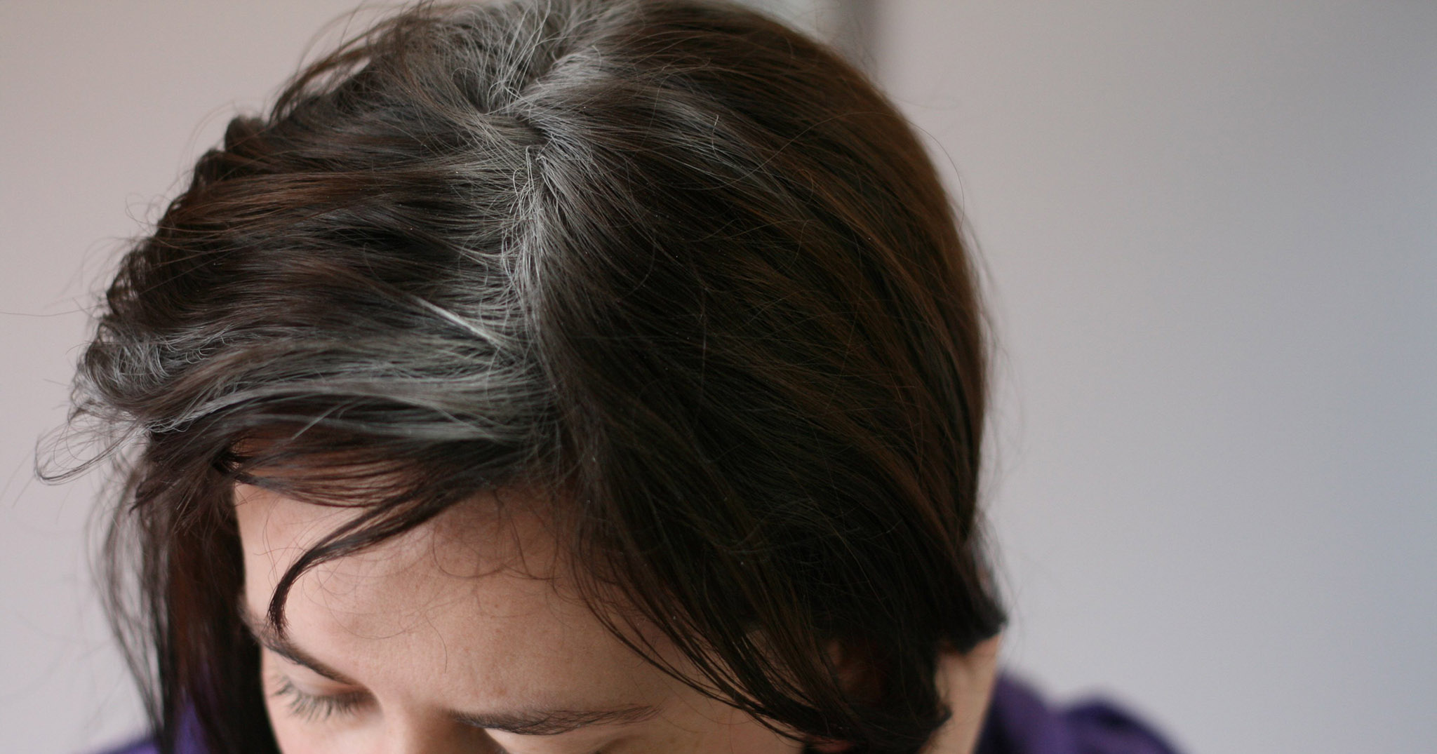 Một vài lý do và nguyên nhân tại sao tóc chúng ta lại bị bạc