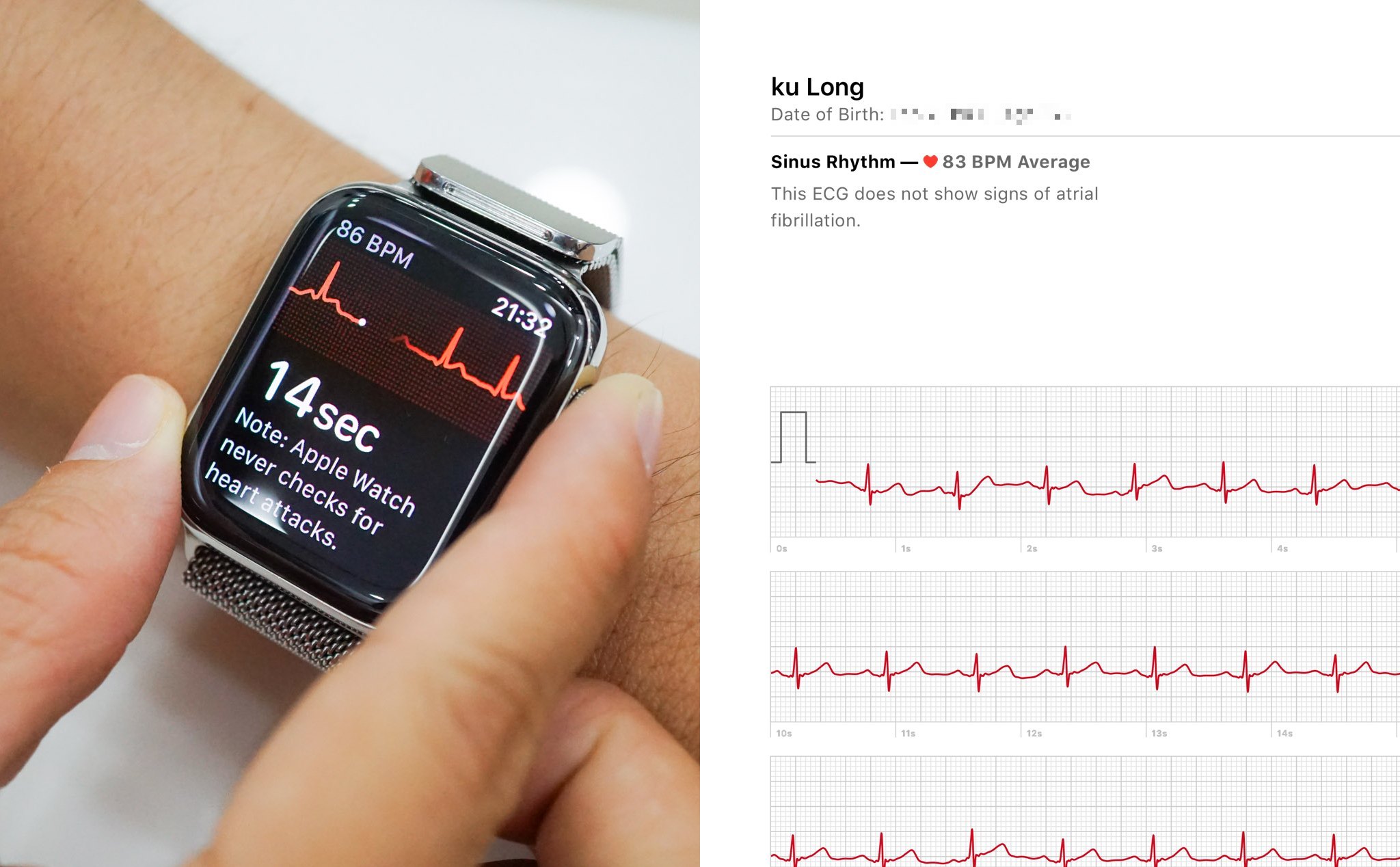 Trên tay ECG: App đo điện tâm đồ bằng Apple Watch 4 - Hiện máy cho thị trường Mỹ mới dùng được