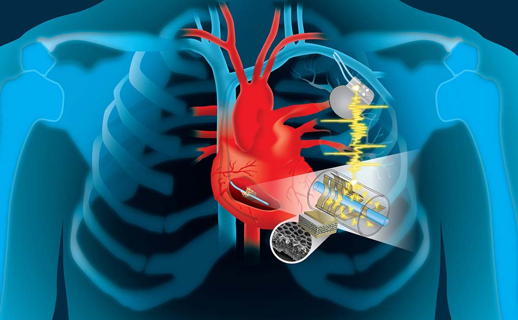 Đại học Y Texas đang nghiên cứu máy biến nhịp tim thành năng lượng điện