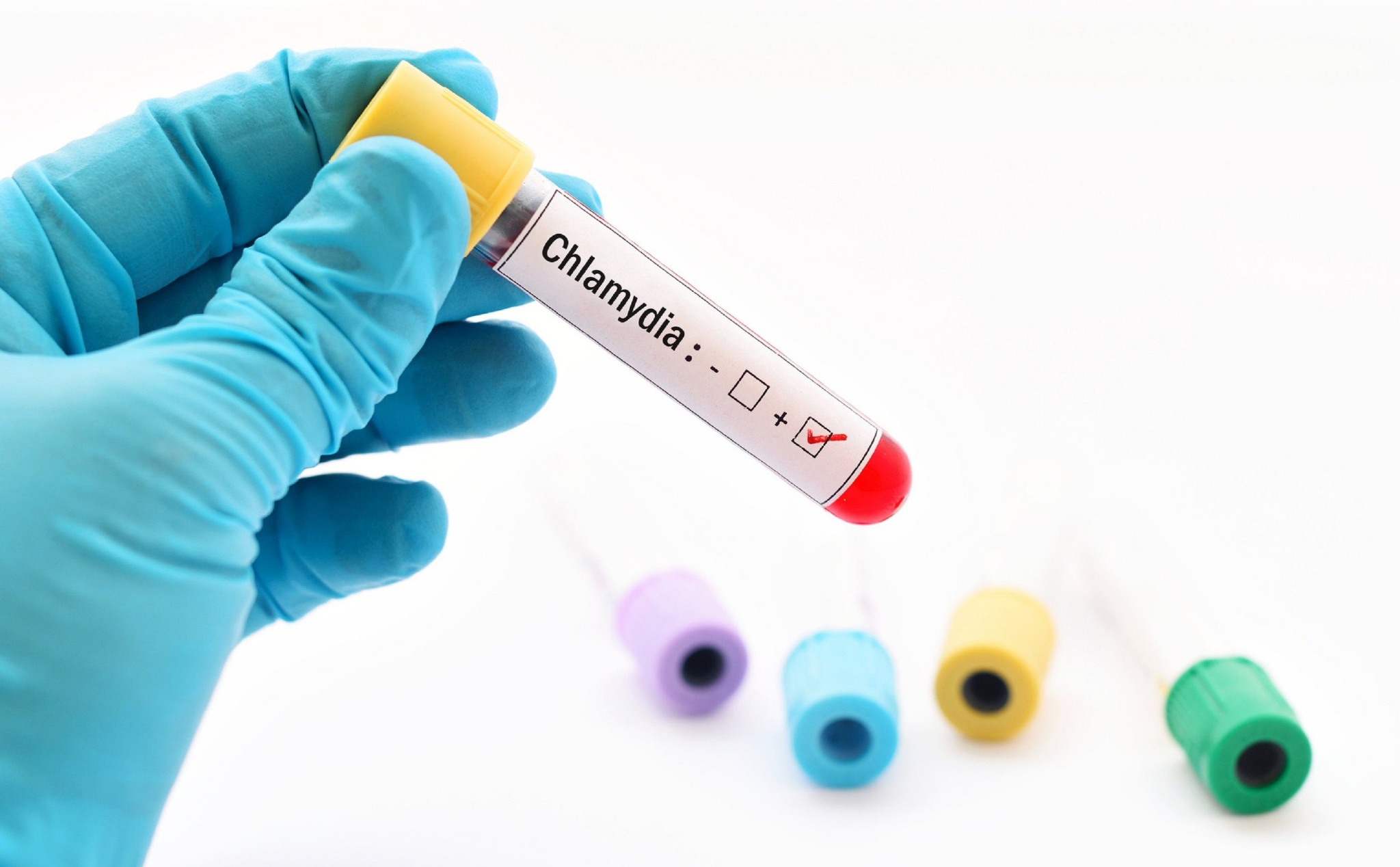 Vaccine đầu tiên phòng chống bệnh qua đường tình dục Chlamydia chuẩn bị đưa vào thử nghiệm lâm sàng