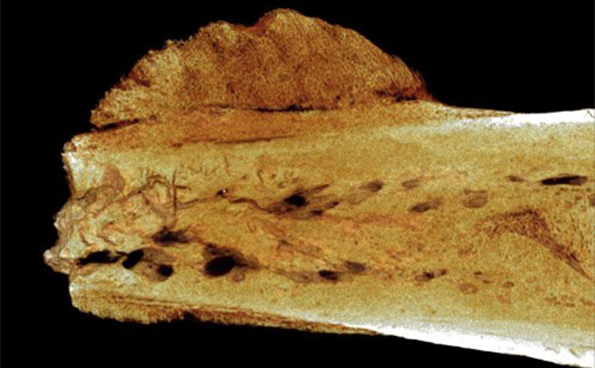Đây là dấu tích xưa nhất của bệnh ung thư: Tế bào ung thư trong khúc xương gần 2 triệu năm