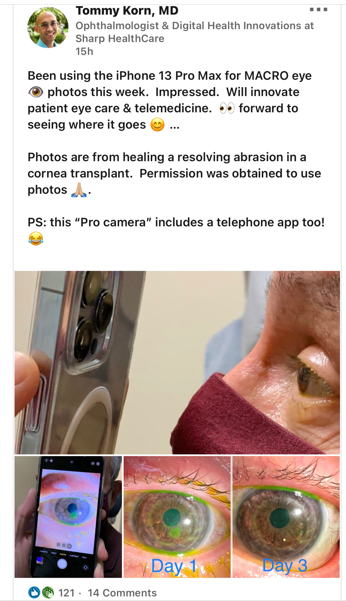 Trong một bài đăng trên LinkedIn, một bác sĩ khoa mắt đã chia sẻ về cách anh ấy đã sử dụng chiếc...