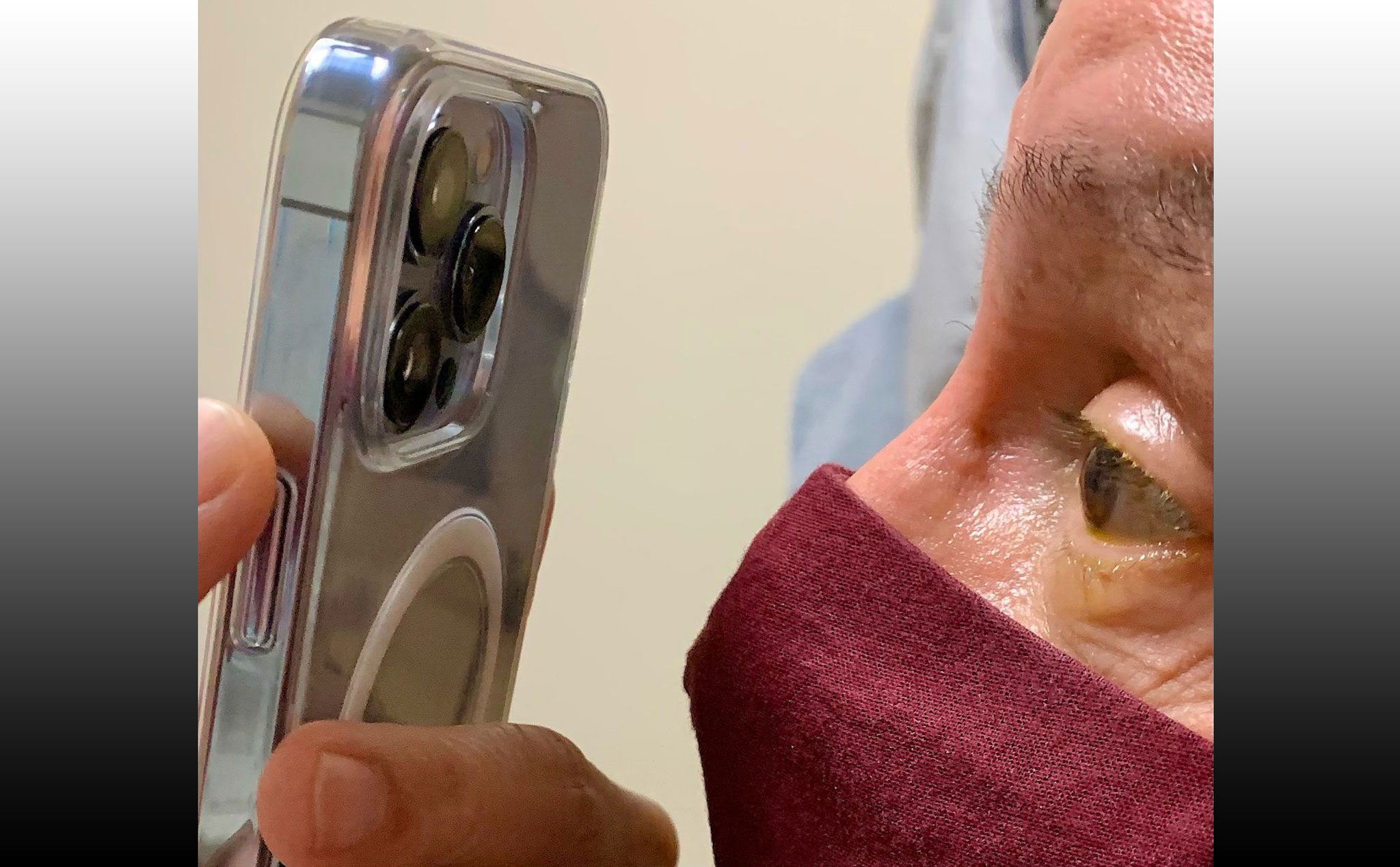 Bác sĩ nhãn khoa sử dụng chế độ Macro trên iPhone 13 Pro để kiểm tra mắt của bệnh nhân