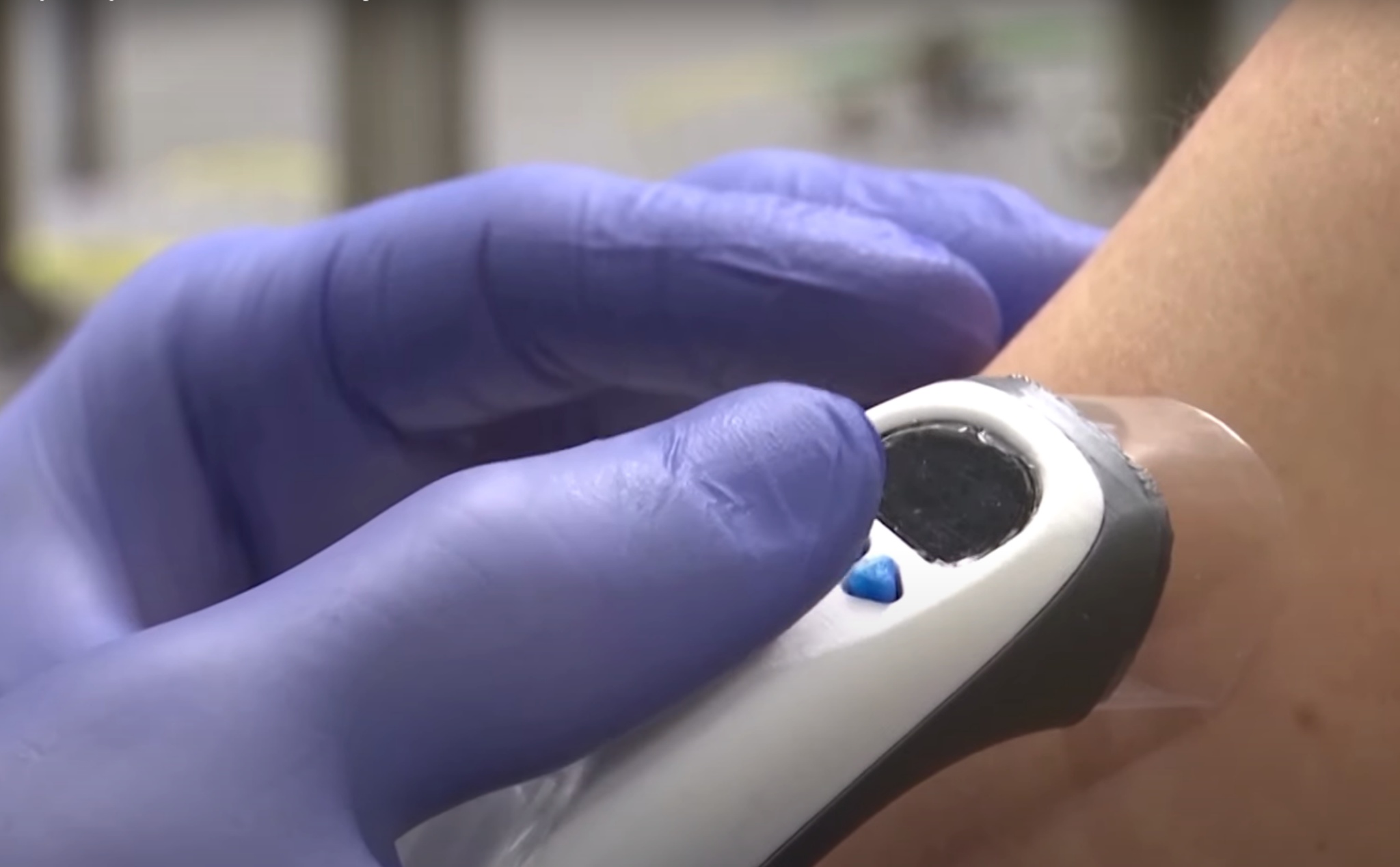 Tiêm vắc-xin bằng laser, công nghệ dành cho người sợ kim tiêm