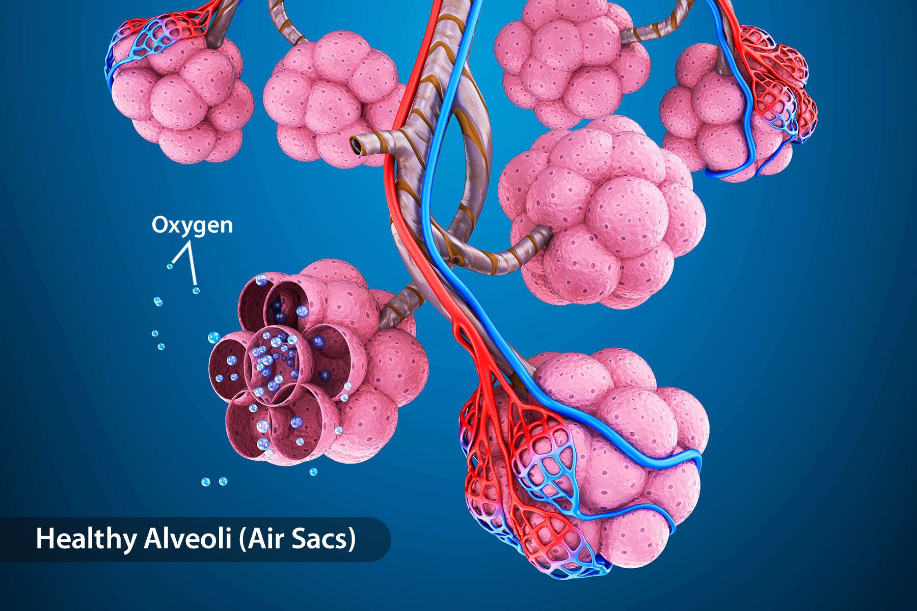 1800ss_getty_rf_healthy_alveoli.jpg