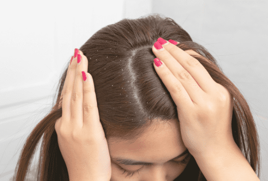 Làm sao để đối phó với các bệnh da đầu thường gặp?