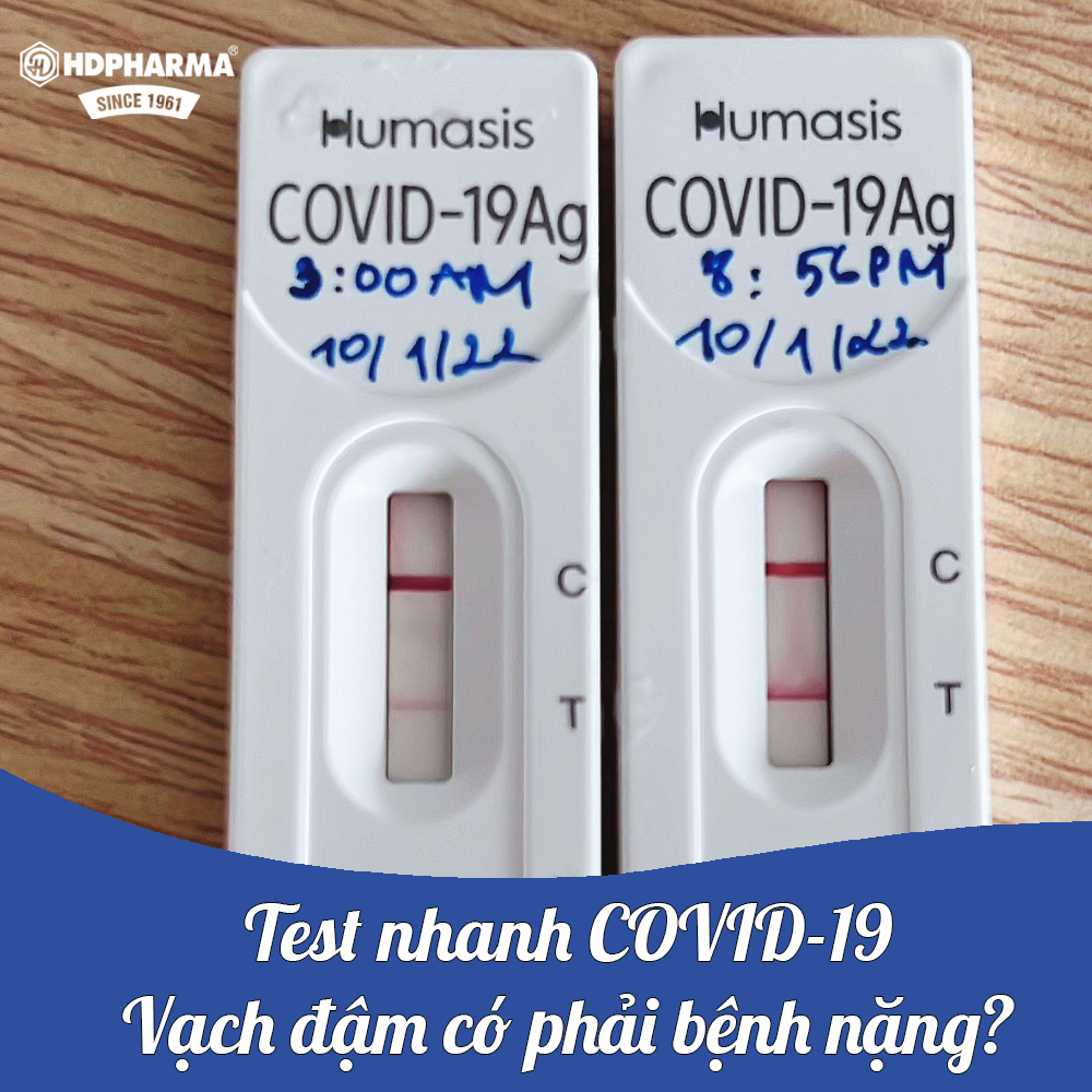 Test nhanh COVID-19 tại nhà, vạch đậm có phải bệnh nặng?