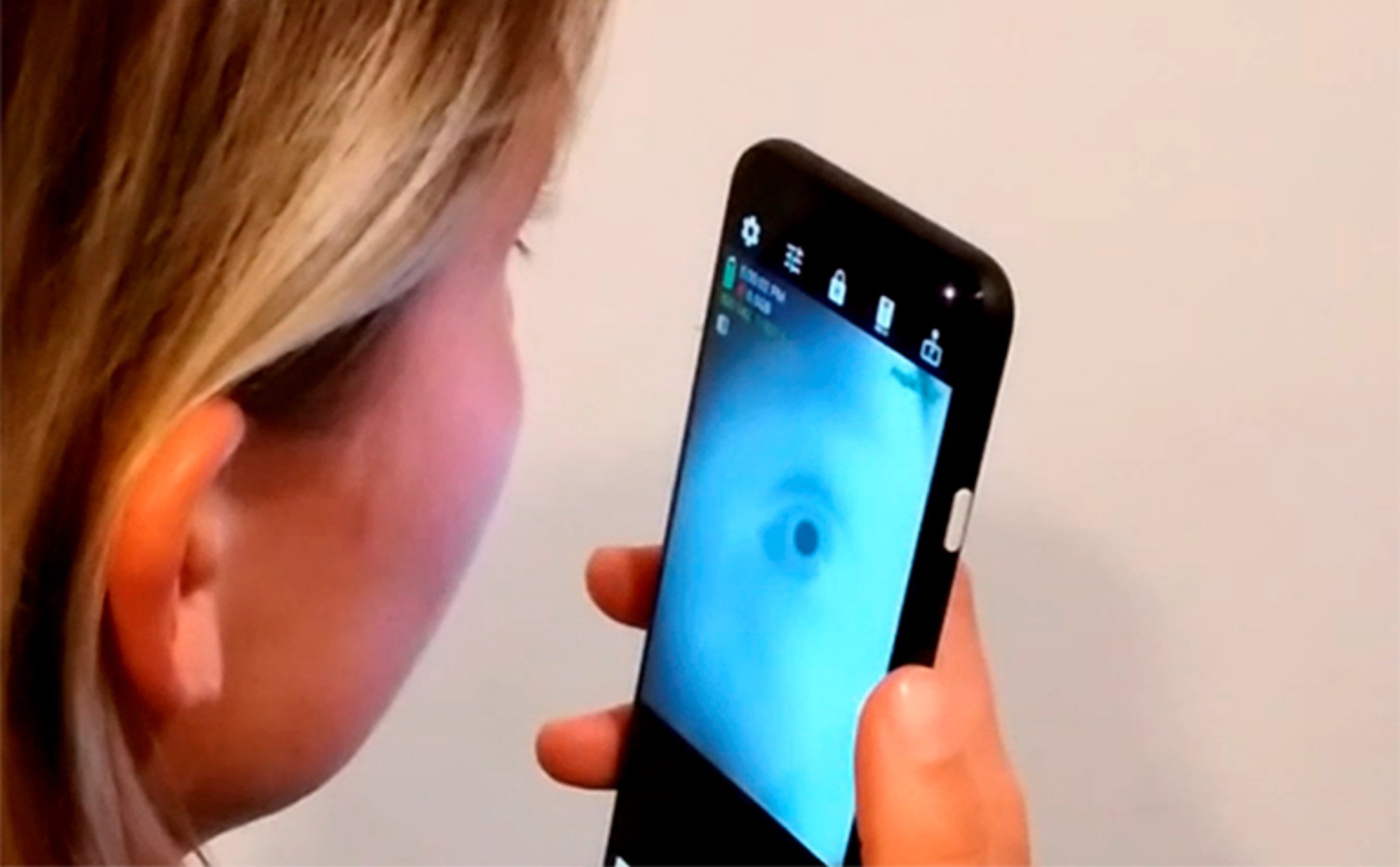Dùng ứng dụng smartphone đo kích thước đồng tử để kiểm tra các nguy cơ rối loạn thần kinh