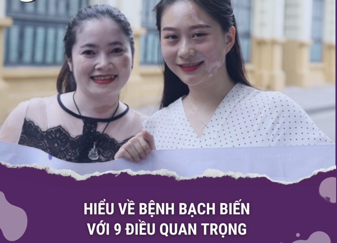 HIỂU VỀ BỆNH BẠCH BIẾN VỚI 9 ĐIỀU QUAN TRỌNG