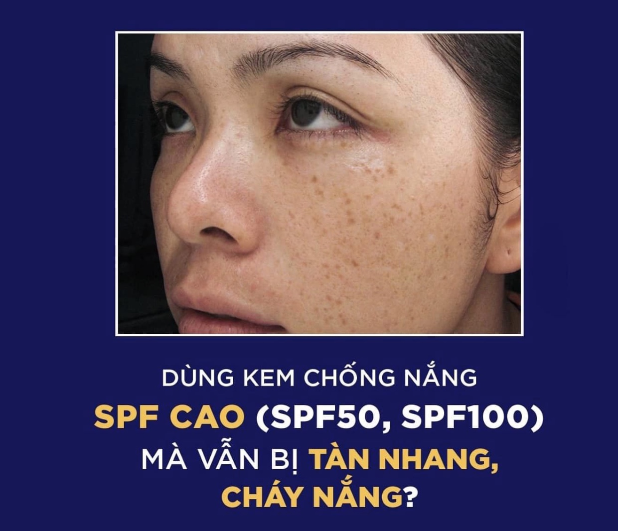 KEM CHỐNG NẮNG SPF CAO CÓ THẬT SỰ TỐT HAY CHỈ MANG LẠI CẢM GIÁC AN TÂM "GIẢ"?