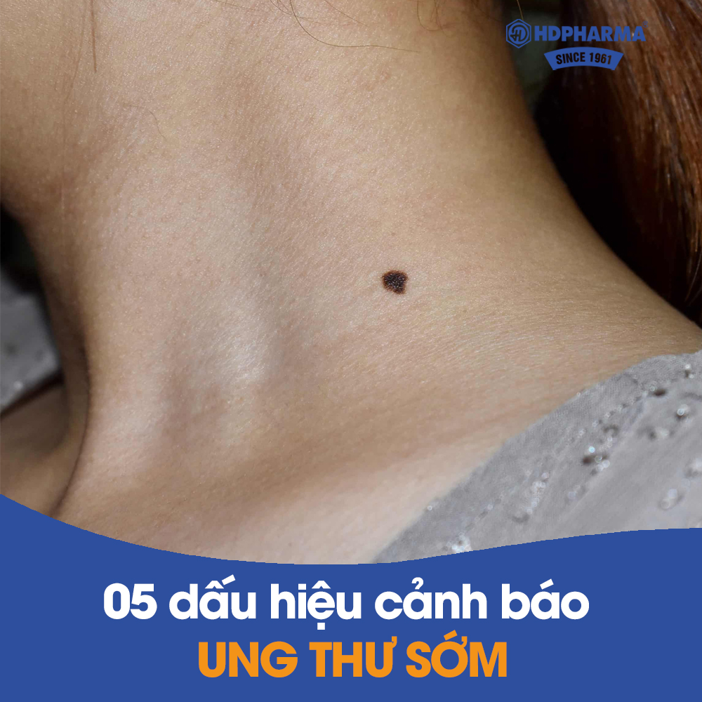 05 DẤU HIỆU CẢNH BÁO UNG THƯ SỚM