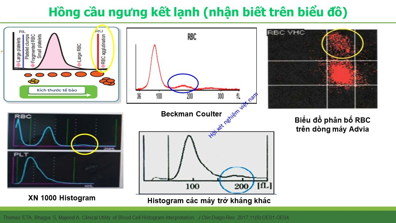 HỒNG CẦU NGƯNG KẾT LẠNH - Cold Agglutinin