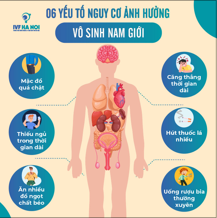 6 YẾU TỐ NGUY CƠ ẢNH HƯỞNG VÔ SINH NAM GIỚI