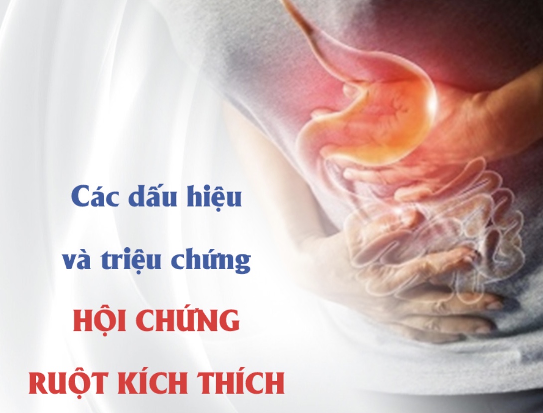 CÁC DẤU HIỆU VÀ TRIỆU CHỨNG HỘI CHỨNG RUỘT KÍCH THÍCH