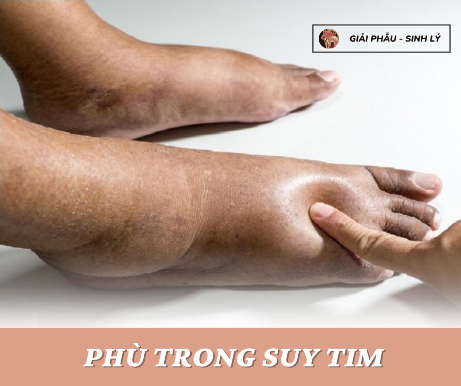 PHÙ TRONG SUY TIM