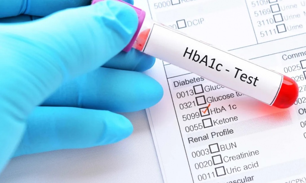 HbA1c là gì? Một số điều nên biết về HbA1c?