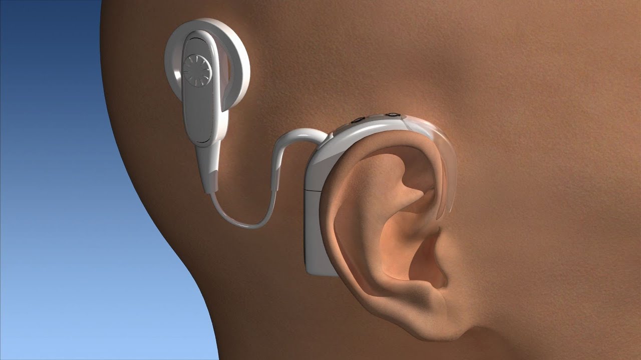 tinhte-fda-hearing-aid-2.jpg