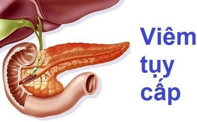 Vì sao có hiện tượng hạ calci máu trong viêm tụy cấp ?