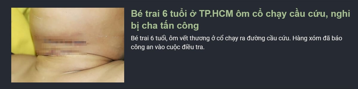 mới nhìn cái hình cũng hơi lú