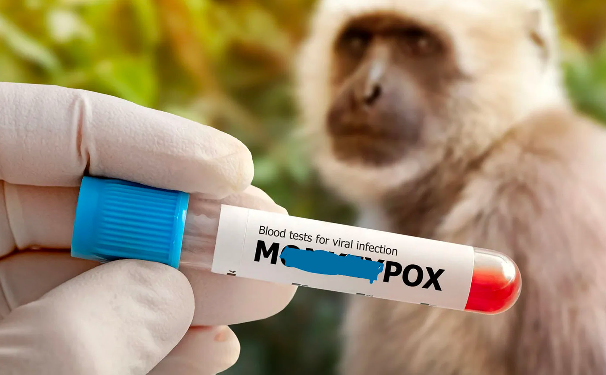 WHO: Bệnh đậu mùa khỉ (monkeypox) từ giờ sẽ được gọi là mpox
