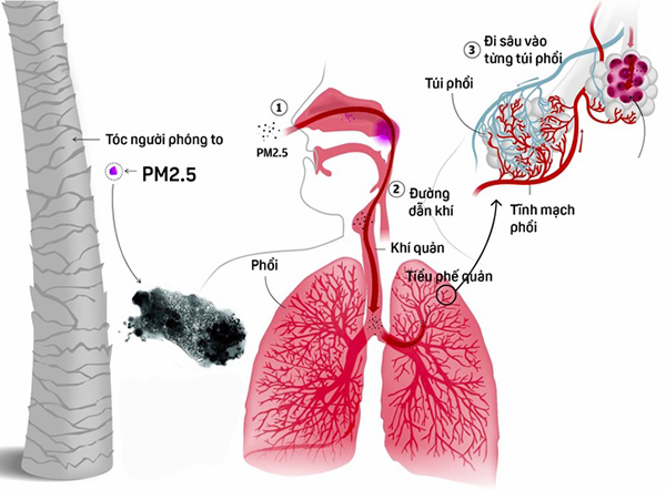 Bụi mịn PM2_5 và PM10 - Sát thủ vô hình của con người hình 4.jpg