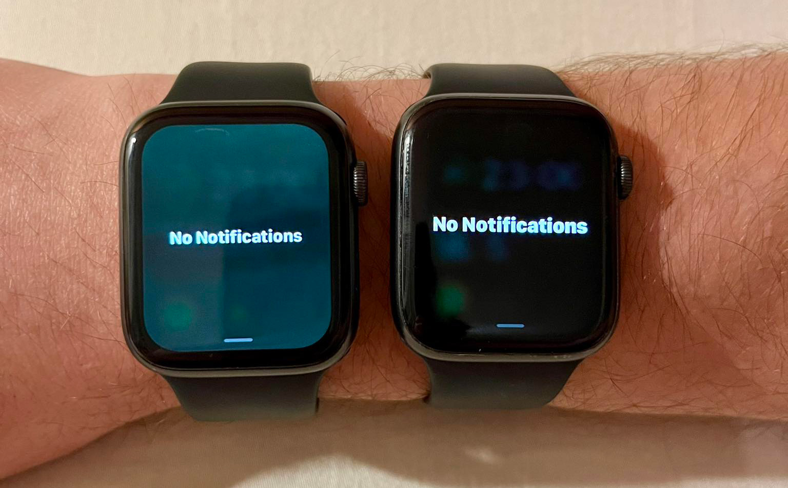 Nhiều người dùng Apple Watch bị hiện tượng “màn hình xanh” sau khi cập nhật watchOS 9.5