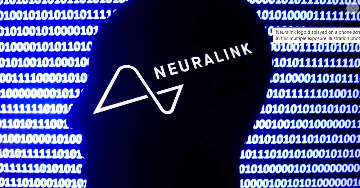 Neuralink thông báo FDA chấp thuận nghiên cứu lâm sàng trên người.