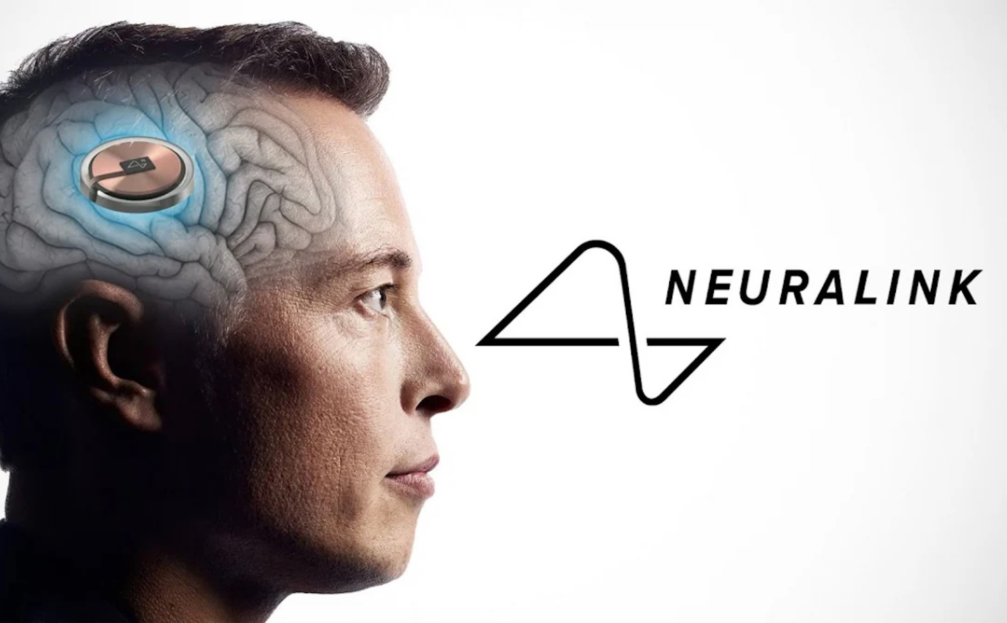 Công ty cấy ghép não của Elon Musk - Neuralink đã được chấp thuận nghiên cứu trên người