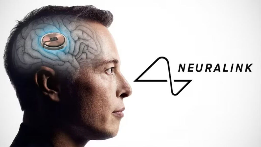 Neuralink sẵn sàng được cấy vào tình nguyện viên thứ hai